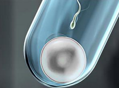 做试管婴儿，这些你满足吗？