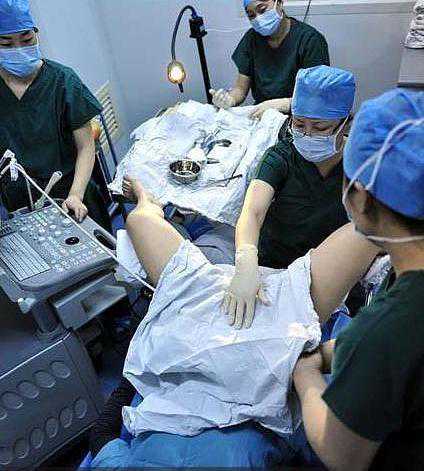 试管婴儿一超是双胎,老公坚决要减胎! 试管婴儿一超是双胎,老公坚决要减胎!