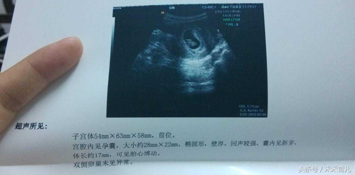 42岁试管终于移植成功，惊喜之余竟有这么多事项需要注意