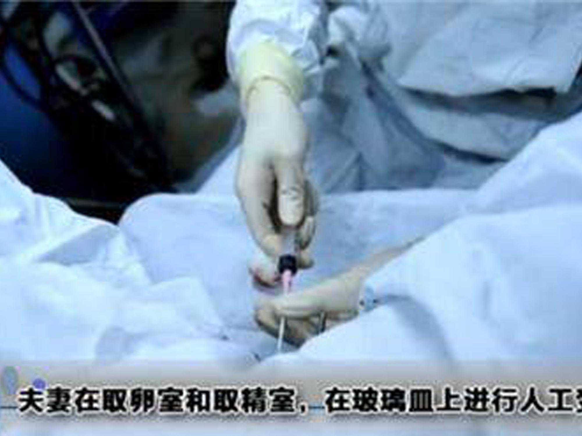 试管婴儿的过程是很艰辛的,这个步骤最难过,准妈妈牺牲很大 试管婴儿的过程是很艰辛的,这个步骤最难过,准妈妈牺牲很大